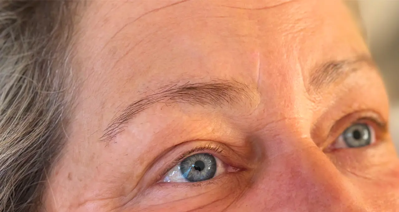 augen_001