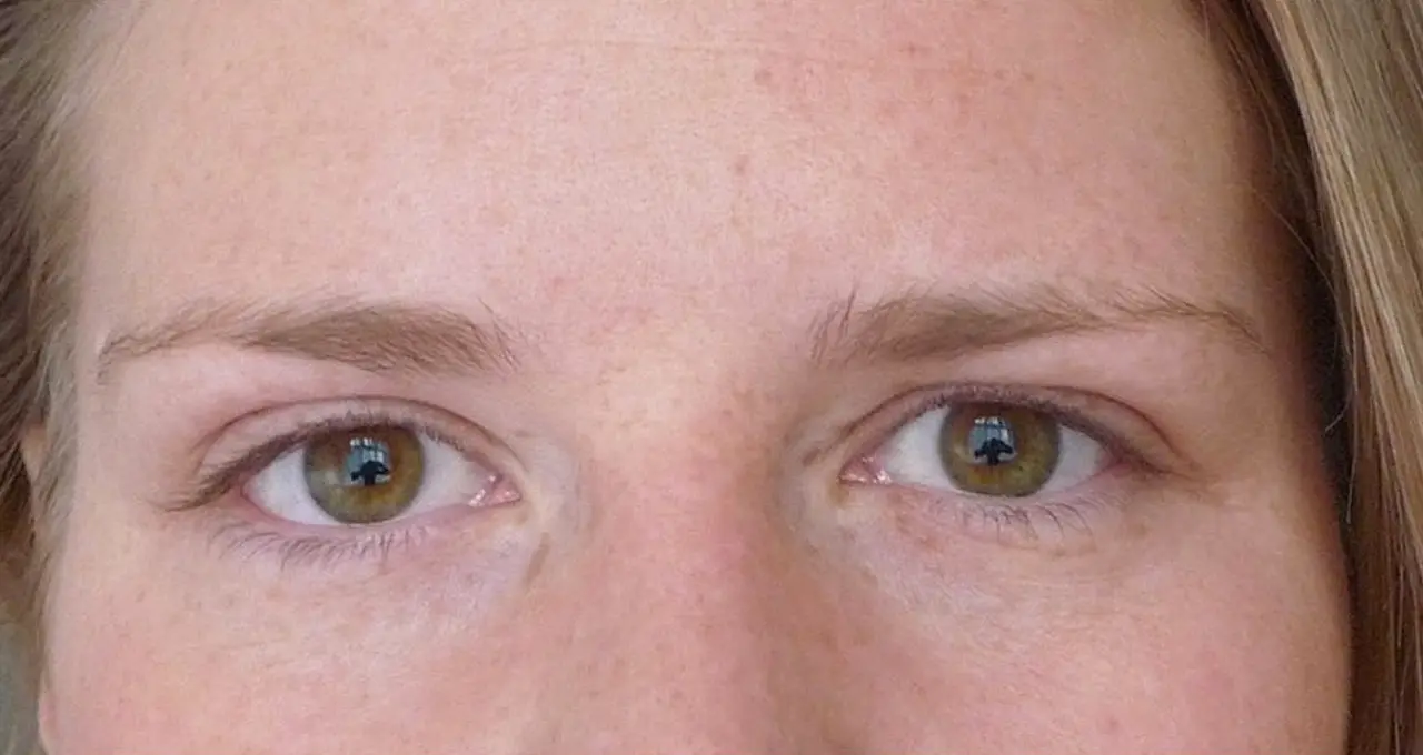augen_003a