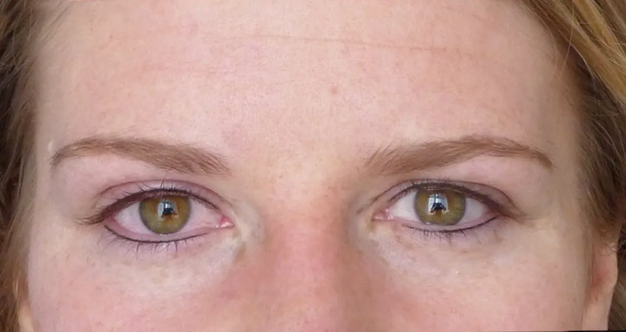 augen_003b