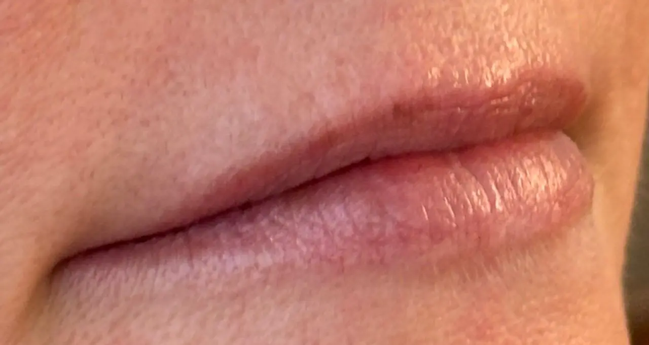 lippen_001