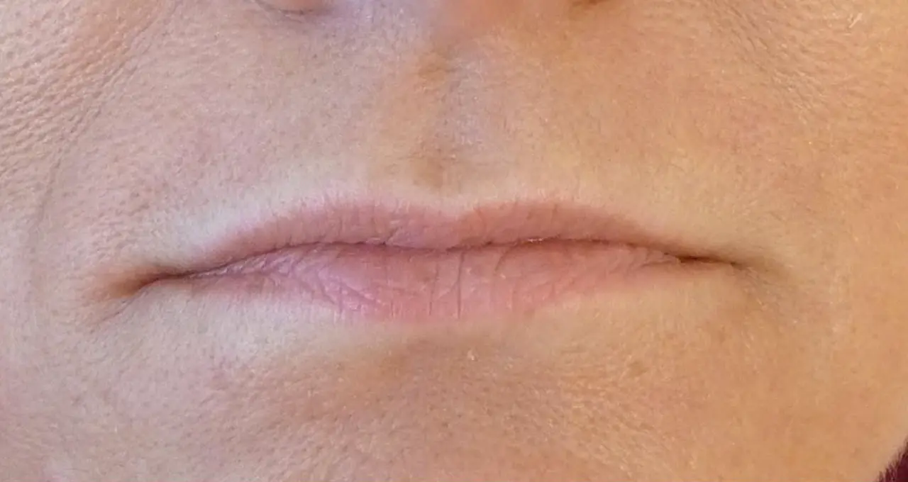 lippen_003a